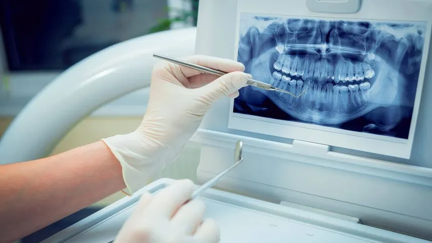 Cirugía Guiada de Implantes
