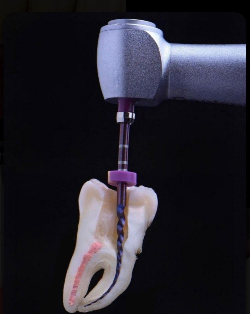 Endodoncia