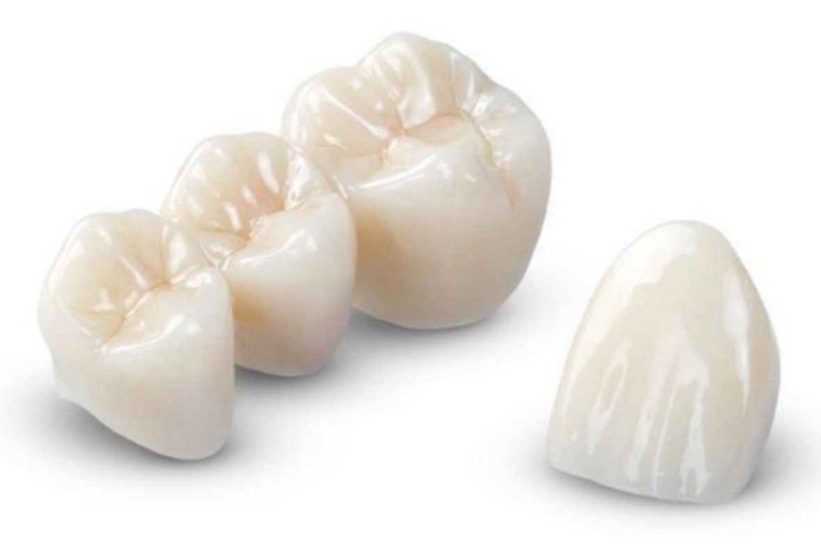 Prótesis Fija